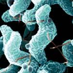Infections Salmonella or Campylobacter 8-10 fold increase risk in one year Risk diminishes but last 10 years Bacterial flora abnormal Jess T, Simonsen J, Nielsen NM, et al.