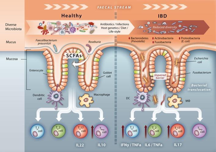 Microbiome in IBD Reduced