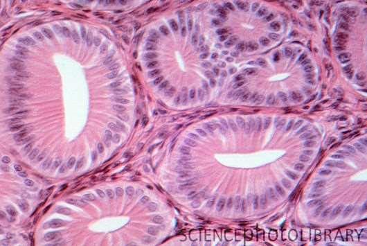 Glandular Epithelium Cells are