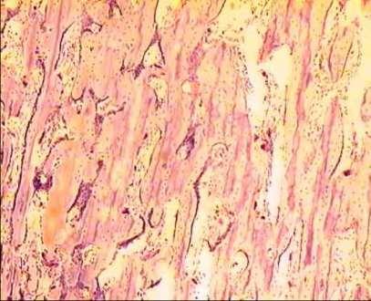 Bone Tissue (Osseus) Osteocytes Cell of bone tissue.