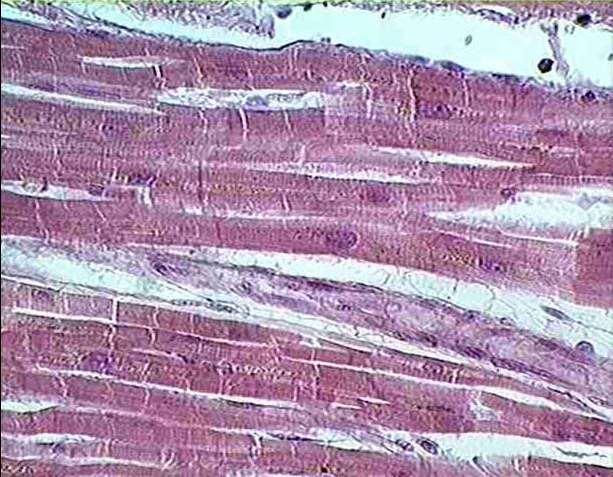 Cardiac muscle Found only in the heart.