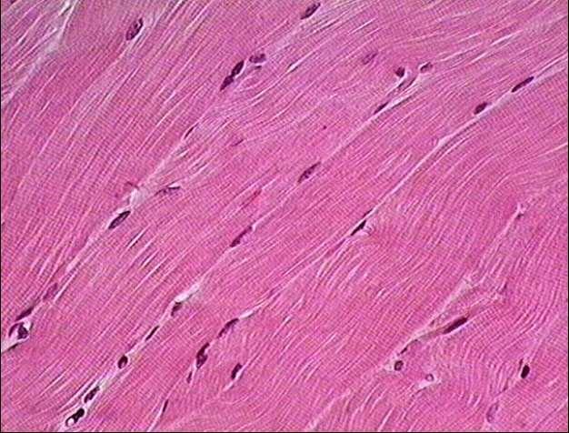 Skeletal muscle Long, threadlike cells with light and dark crossmarkings, striations, that has many nuclei located just beneath the cell