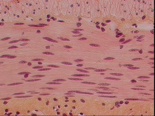Smooth muscle Cells lack striations and are shorter than skeletal muscles with a centrally located nucleus.