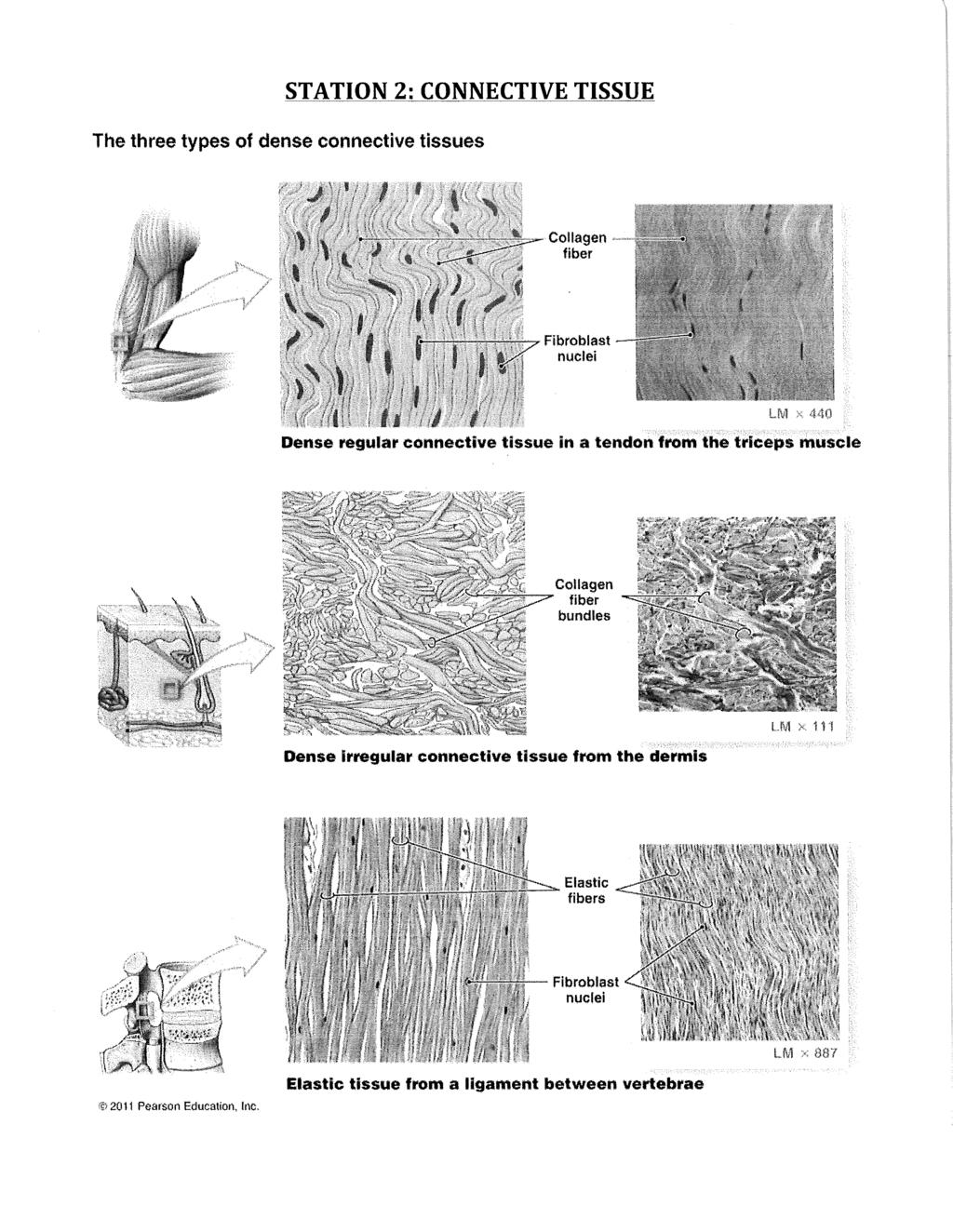 STATION 2: CONNECTIVE TISSUE The three types of dense connective tissues Collagen fiber Fibroblast nuclei tfcl x 440 Dense regular