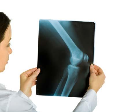 OSTEOARTHRITIS: WHY IT S A PAIN IN THE KNEE & WHAT YOU CAN DO ABOUT IT What every patient