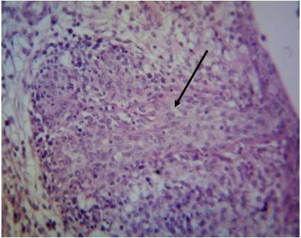 (Plate VI). All the sections of the bursa had many macrophages, fibroblastic and reticular cells.
