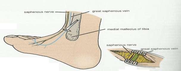 passes directly in front of the medial malleolus of the