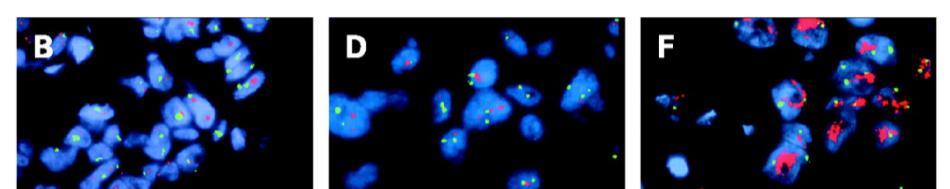 fluorescent in situ hybridization Non-amplified =