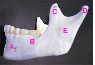 Mandible A. mental foramen - The front opening of the mandibular canal on the body of the mandible alongside and above the tubercle of the chin. B. body C.