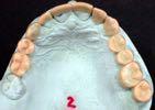 1.Initial periodontal assesment & stabilization 2.