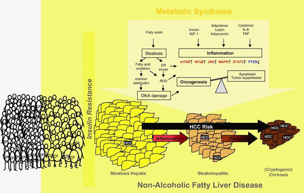 Molecular mechanisms linking non-alcoholic fatty liver disease