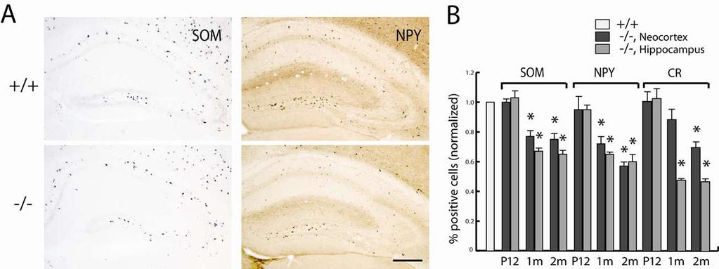 Cortical interneuron density is reduced in Dlx1 mutant mice Cobos et al. Nat.