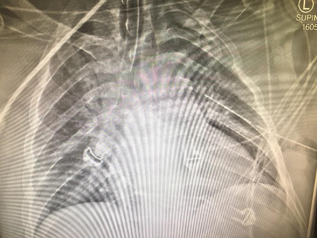 19 October 2017 19 Imaging (X-Rays) Required CXR: 6 CT Scans: 3 (Head, neck, trunk, spine, ankle)