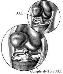 Ligaments Less rigid than bone Do not stretch as much as tendons Tissue that attaches one or more bones