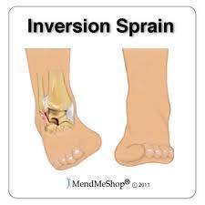 ANKLE SPRAINS Inversion Sprains 80-85% of all ankle sprains are to the lateral ligaments -- inversion sprains Commonly referred to as