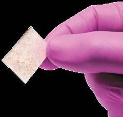 Neoderm can be used to replace damaged or inadequate tissue for the repair, reinforcement, or supplemental support of soft tissue defects.