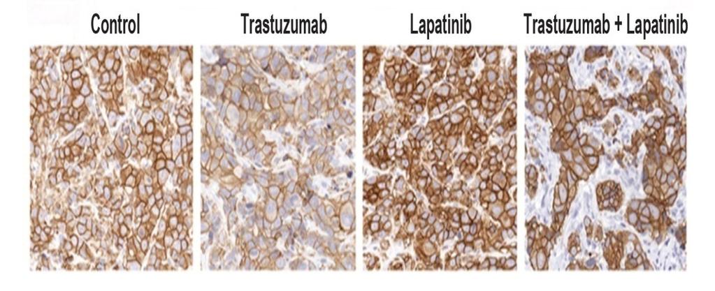 Combination of Lapatinib and Trastuzumab Has Superior Antitumor Activity Treatment with lapatinib plus trastuzumab resulted in complete tumor remission Effect was durable: no tumor relapse observed