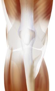 UW HEALTH SPORTS REHABILITATION Rehabilitation Guidelines for Patellar Tendon and Quadriceps Tendon Repair The knee consists of four bones that form three joints.