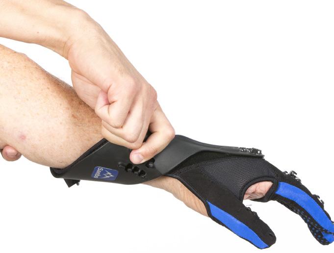 SaeboGlove Apply Wrist Support Once the fingers and thumb are positioned correctly into the glove, apply the Wrist Splint around the forearm and position as proximal as