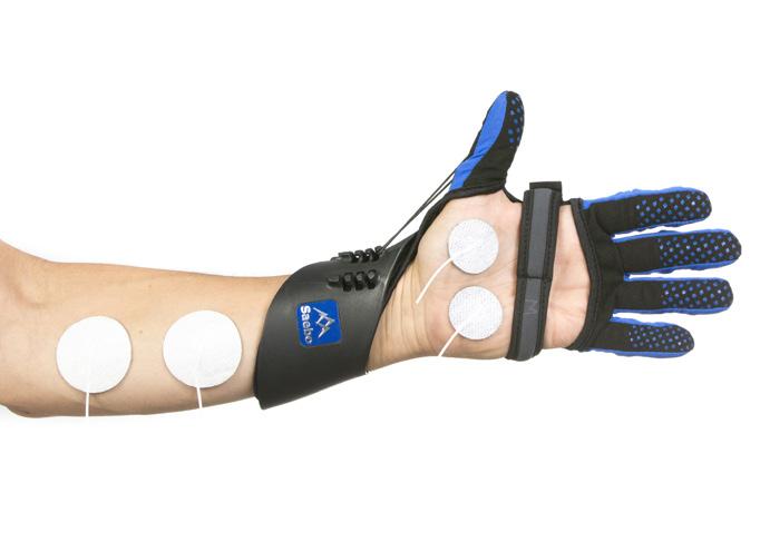 SaeboGlove 4. Unable to Actively Flex Digits (Weak Grasp) If the client exhibits minimal to no active finger flexion, consider combining electrical stimulation (NMES/FES) while using the SaeboGlove.