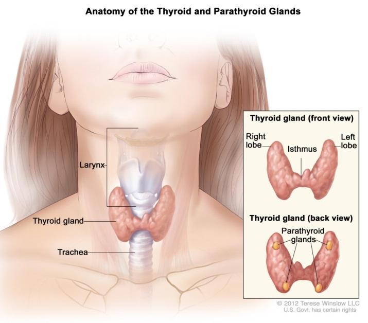 Thyroid cancer The cells of the thyroid gland become abnormal, grow uncontrollably, and form a mass of cells called a tumor.
