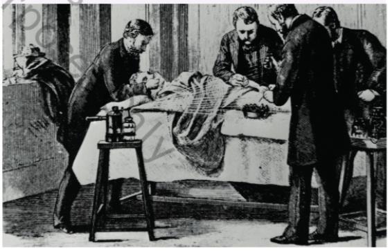 SURGERY IN 1900: Amputation Clip What can you