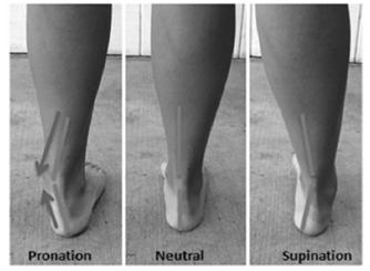 Plantar Flexion: bending forward or bending the foot away from the knee Muscle Tone