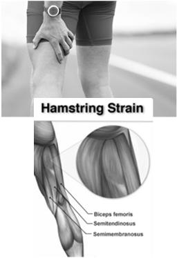 Strain Overstretching or injury to muscles and/or tendons Frequent sites include the back, arms, and legs Prolonged or sudden muscle exertion is usually cause Symptoms: myalgia or muscle pain,