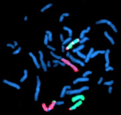metaphases MYC/BCL6 dual colour FISH wcp3 and wcp8 der(3) der(8) 3 der(3) 8 der(8) mar1
