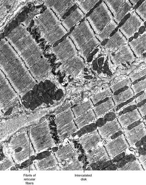 Electron microscopic picture Only 1 or 2 centrally- located pale staining