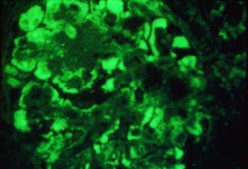Immunofluorescence of renal