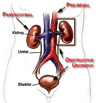 Acute Kidney