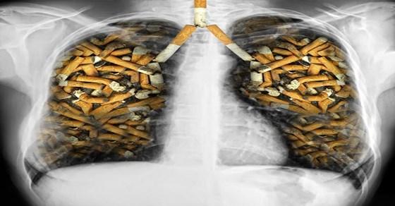 Quitting is Hard 50% of people who recover from lung cancer surgery start smoking again afterwards.