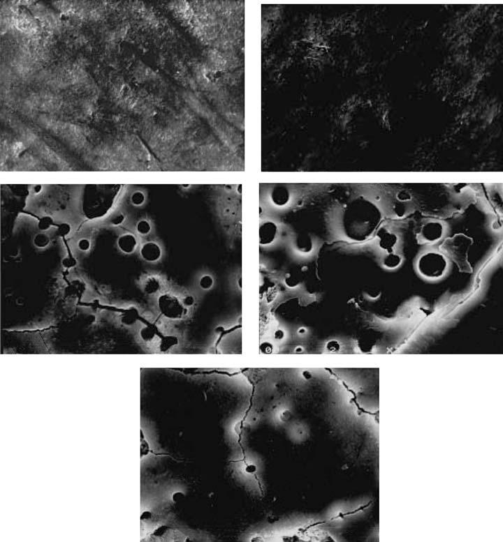 1466 BOARI et al. (a) 10 µm 10 µm (b) (c) 10 µm (d) 10 µm (e) 10 µm Fig. 2. Scanning electron microscopy of enamel after irradiation with Nd:YAG laser at 60 mj per pulse (84.