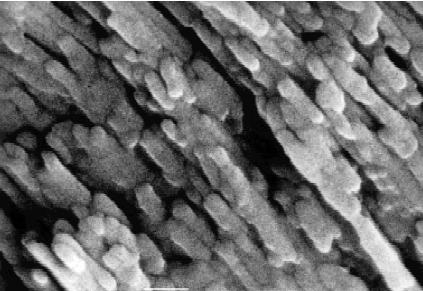Bundles of crystals come together to form long prismatic structures that extend from the dentin to the enamel surface, oriented in a fashion to protect the inner layers of the tooth s structure from