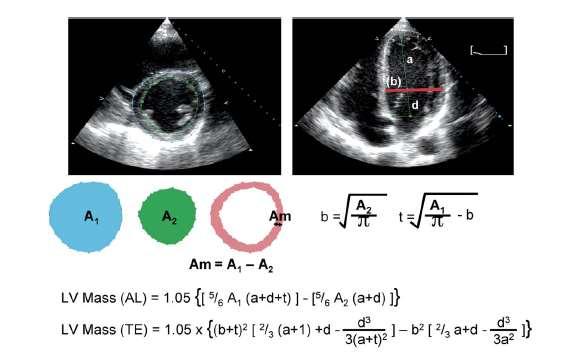 method may be used in the presence of RWMA Measurements at end diastole, papillary