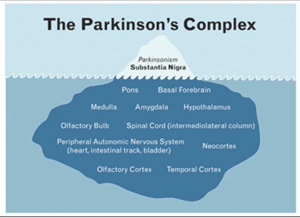 Parkinson s as a