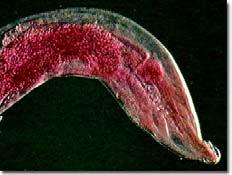 vermicularis, the human pinworm. b.