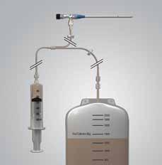 Thora-Para catheter drainage system Our Thora-Para catheter drainage devices offer time-tested features you need for safe and efficient thoracentesis and paracentesis procedures.
