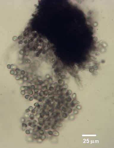 4.2 Identification of conidia Conidial ooze can be scraped from pycnidia on agar cultures or leaf lesions using a scalpel, and mounted on a glass slide in a drop of SDW with a cover slip placed on