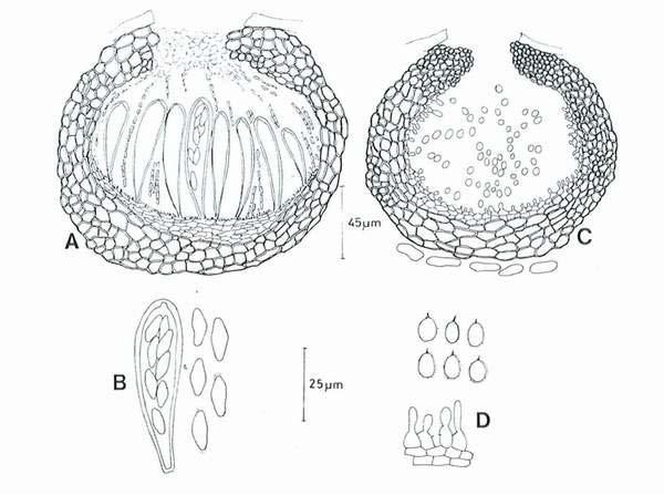 Figure 11. Microscopic description of Guignardia bidwellii; A. pseudothecium, B. ascus and ascospores, C.