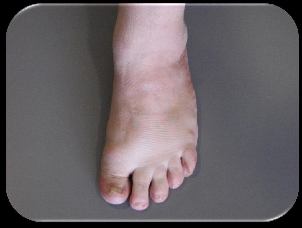 Instep-portion of the foot, or shoe upper, over