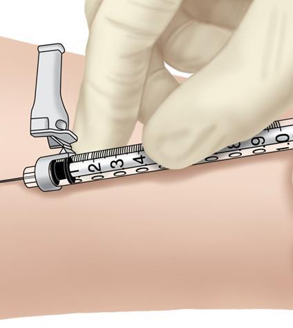 Administering the TST Inject 0.