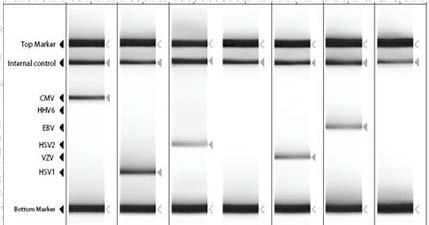 PCR is the method of choice for