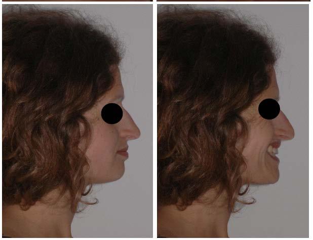Extraoral photographs after treatment. Fig. (8).