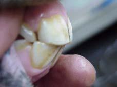 Teeth  