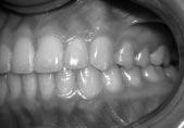 stimulating more biologically compatible tooth movement,