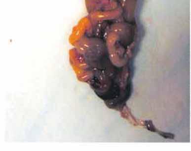 pancreatic stem