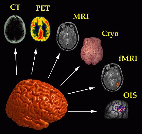 Methods of Cognitive Neuroscience Neurobiology: Neuroanatomy Neurophysiology Neuroimaging Techniques PET