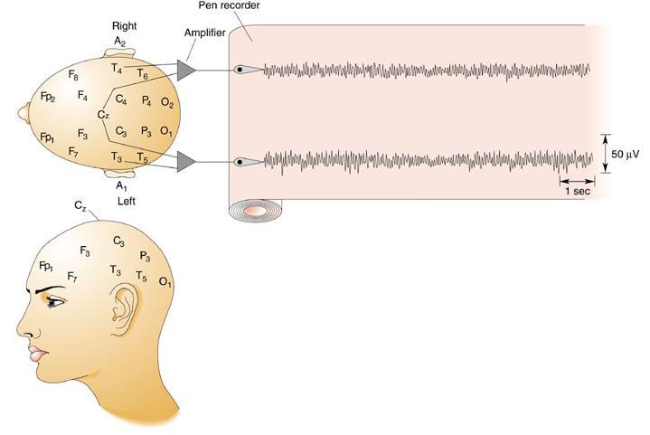 EEG Standard placements of electrodes on the human scalp: A, auricle; C,